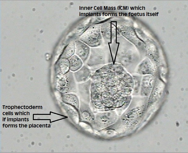Blastocyst with markup of inner cell mass and trophectoderm 