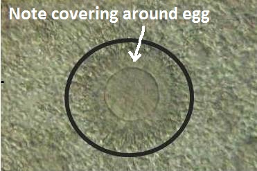 cotton wall covering egg observed during ivf cycle egg collection