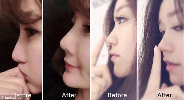 Women in Asia are using the nasal pegs and hook to make their nose look more attractive. The advertisement on Taobao shows models posing for before-and-after pictures with the product