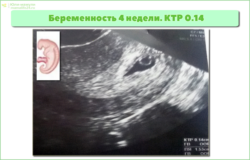 беременность 4 недели фото плода