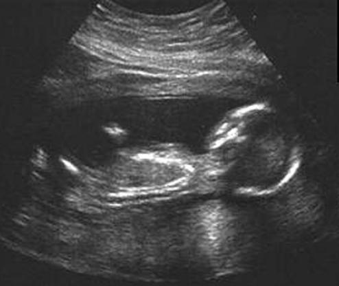 16 недель беременности фото ребенка